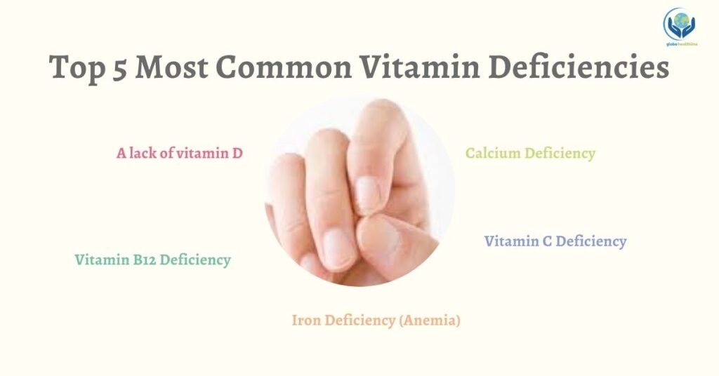Vitamin Deficiencies