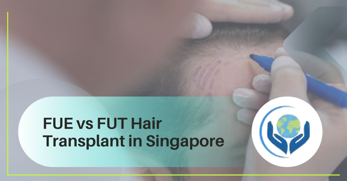 FUE vs FUT Hair Transplant