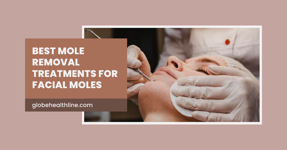 Mole Removal